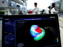 Technology of early warning for heart attacks invented