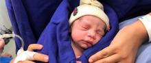First baby born via dead donor's uterus
